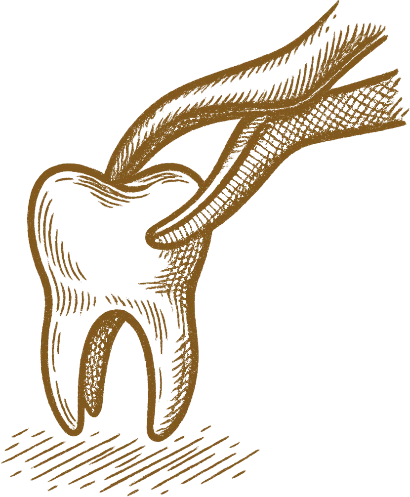 Hand-drawn illustration of a tooth with root and extraction forceps