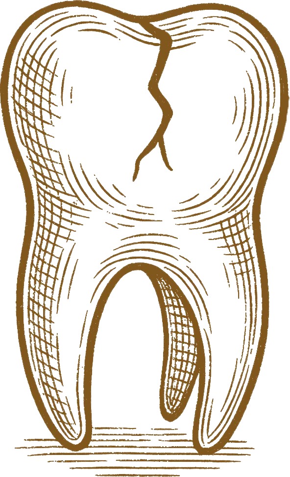 Vintage illustration of a tooth with detailed cross-hatched lines