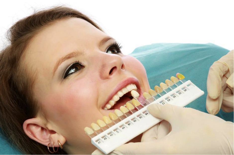 shade guide teeth whitening theperiodontist