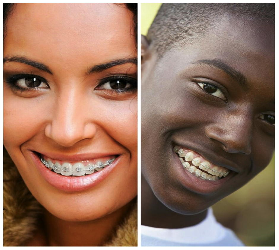 lady black guy wear braces