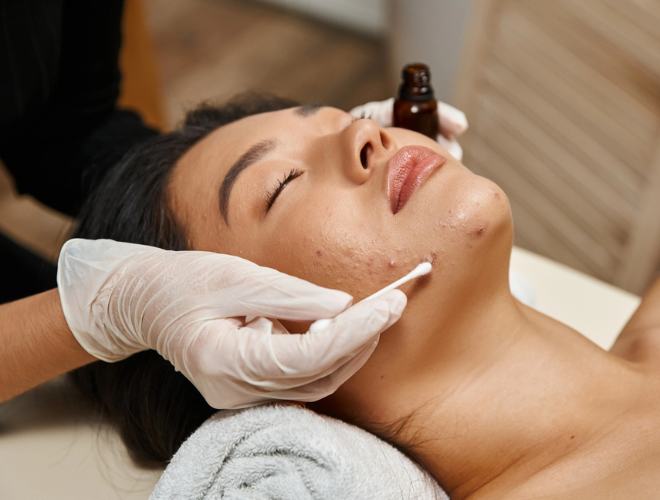 Acne skin treatments at Lee's Summit Skin Care Clinic