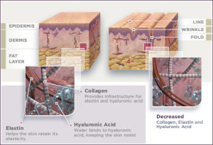 roleofcollagenloss_chart