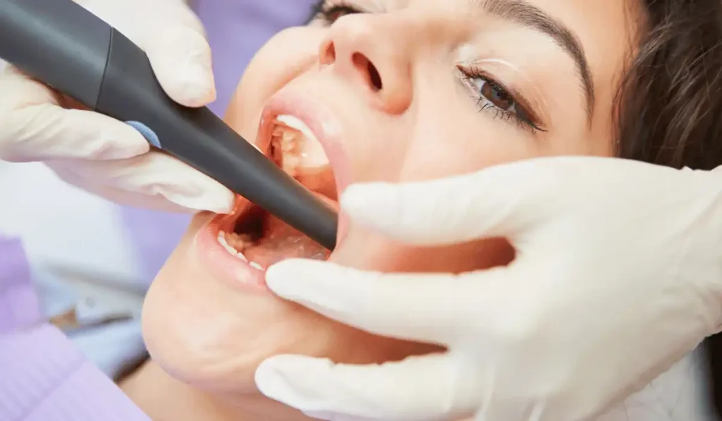 Root Canal 