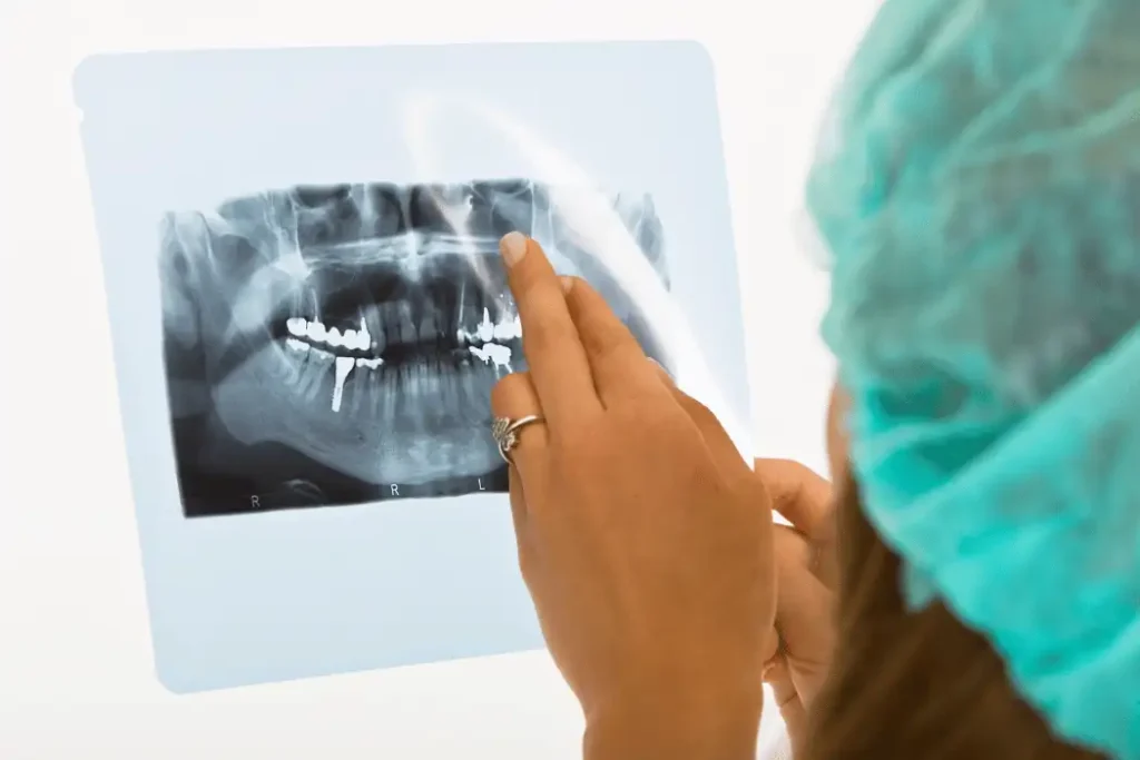 Dental X-Rays