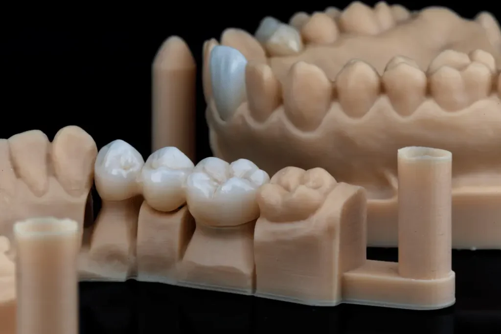 same day crowns 1