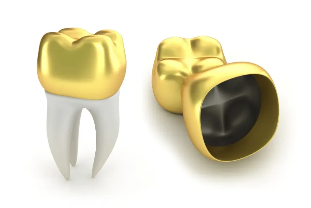 Dental Crowns