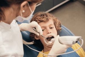 Dental Sealants