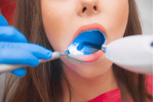 Dental Restoration