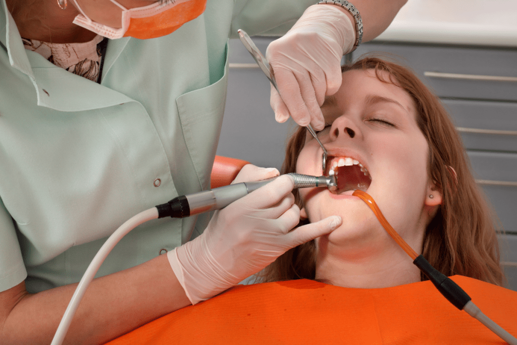 Tooth Polishing
