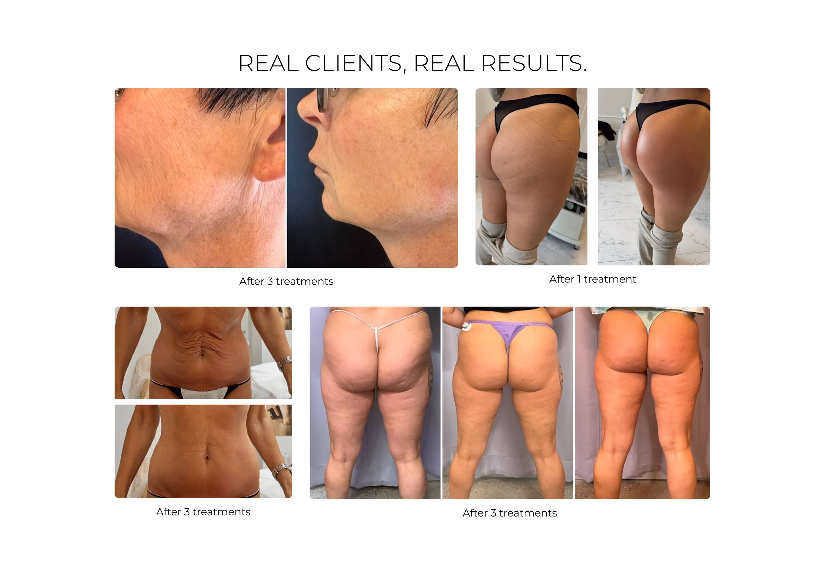 image of before and after cleaning in a kitchen