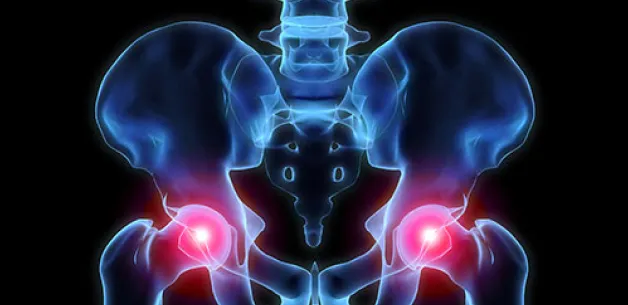 Photo highlighting hip area pain