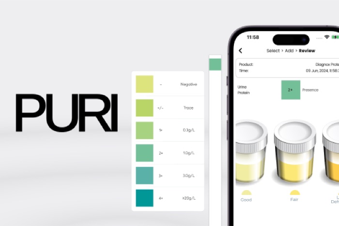 PURI urine test app with colour scale and result review on a phone