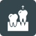 A stylized icon depicting two teeth on a base, representing dental implants or general dental care. 