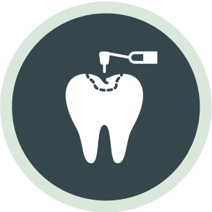 An icon depicting a dental drill working on a tooth, potentially representing a dental procedure or preparation for an implant. 