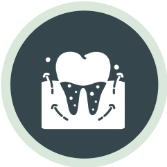 A black circular icon with a white illustration depicting dental implants being placed in a jawbone. 