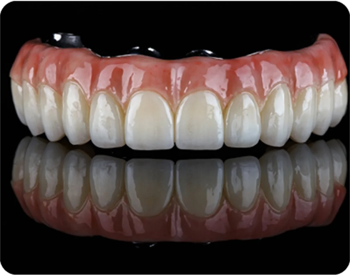 All-on-4 Dental Implants