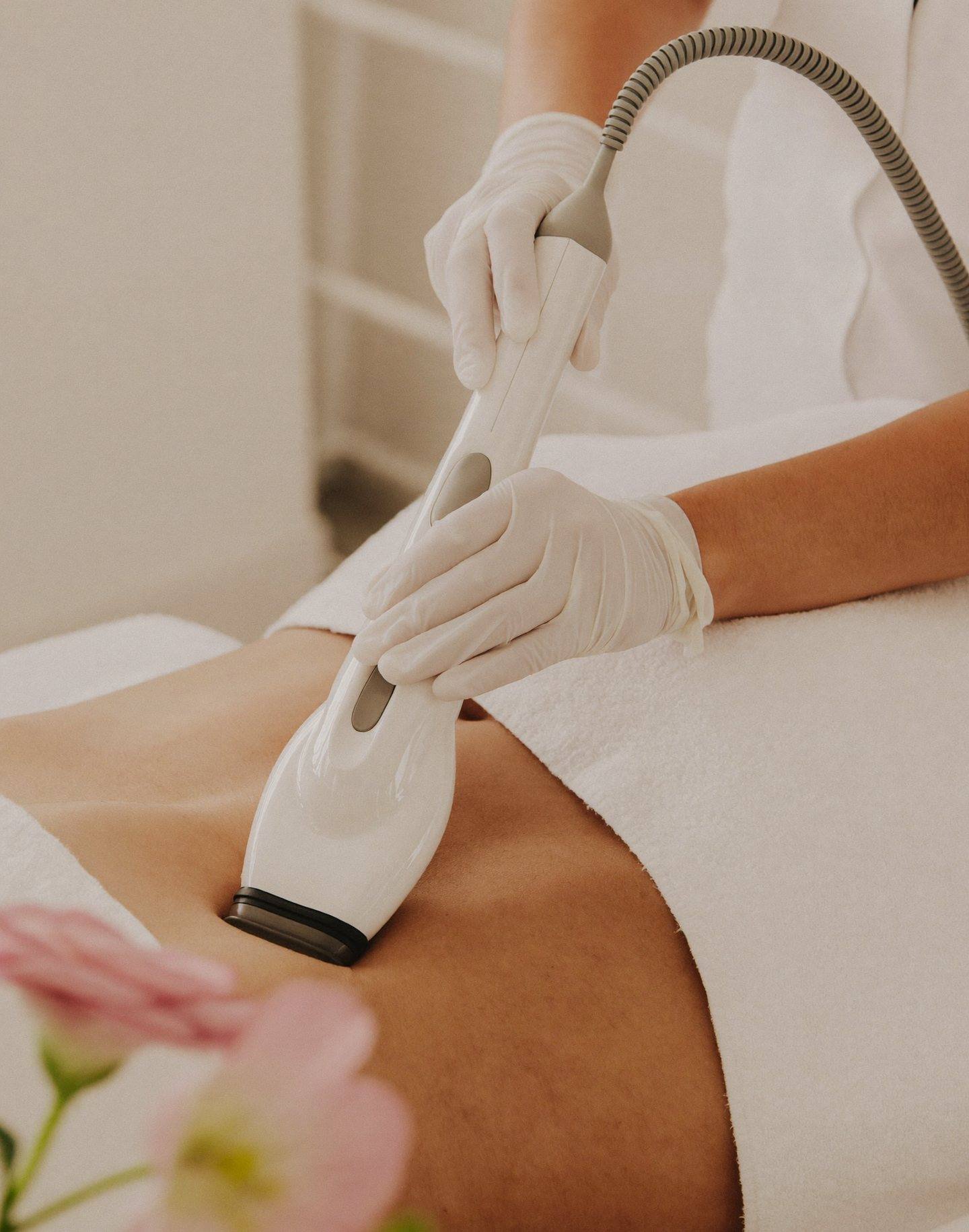 EXION Body — Fractional RF: microneedle RF treatment applied to the abdomen at Sooma Aesthetics