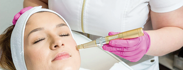 Skin Stylus treatment by Healthy Naturally You in Oro Valley, AZ