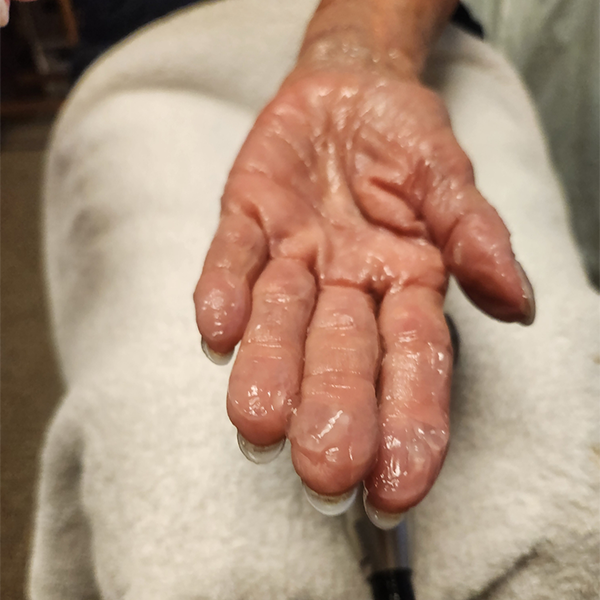 Piezo Wave Arthritis Treatments by Healthy Naturally You in Oro Valley, AZ