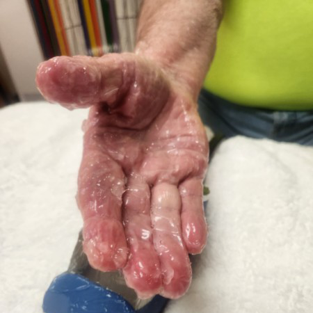 Piezo Wave Arthritis Treatments by Healthy Naturally You in Oro Valley, AZ