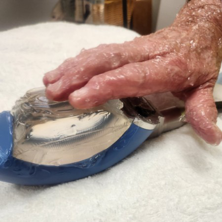 Piezo Wave Arthritis Treatments by Healthy Naturally You in Oro Valley, AZ