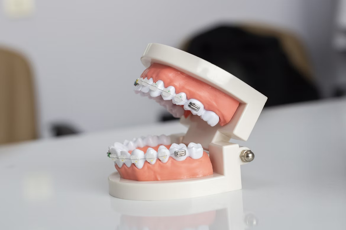 teeth image