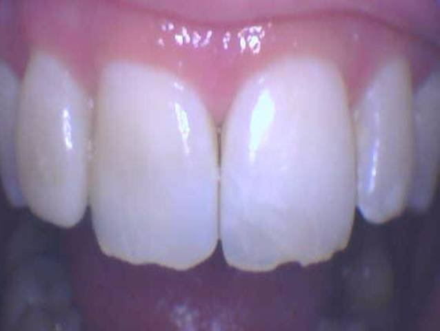 gallery_image