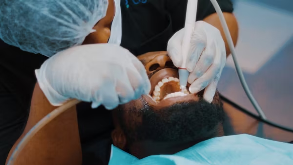 Teeth Whitening