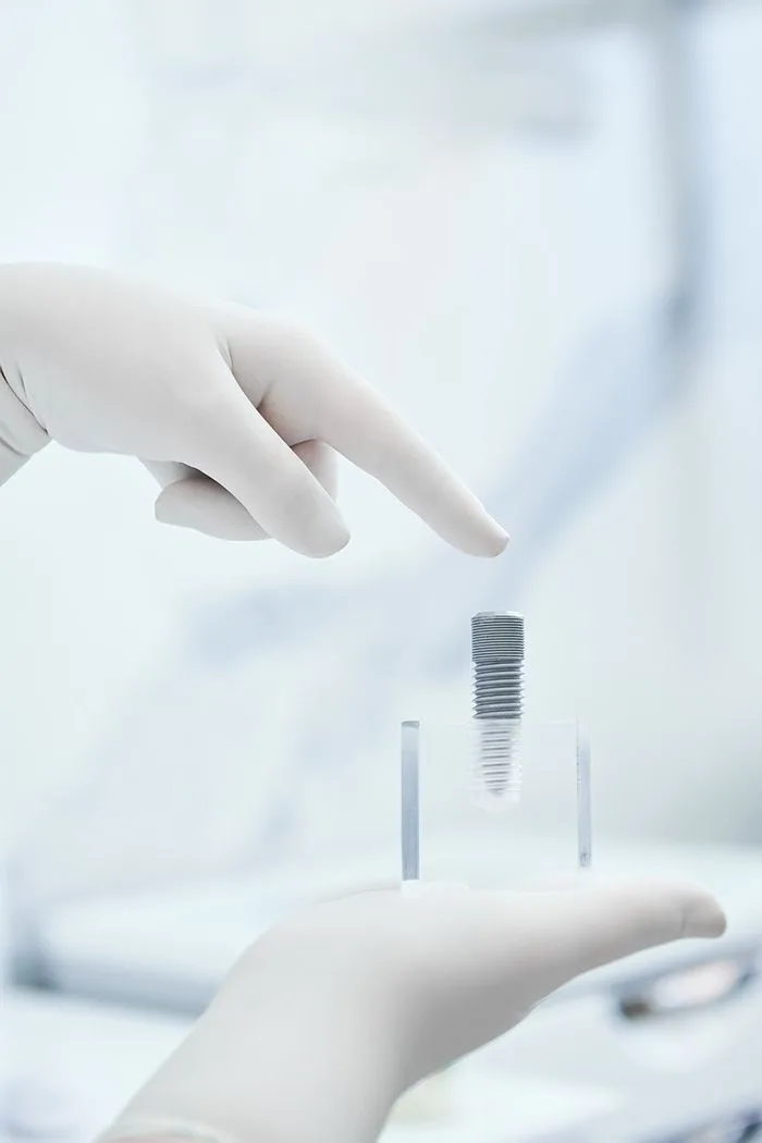 Do You Qualify for Full Arch Dental Implants?