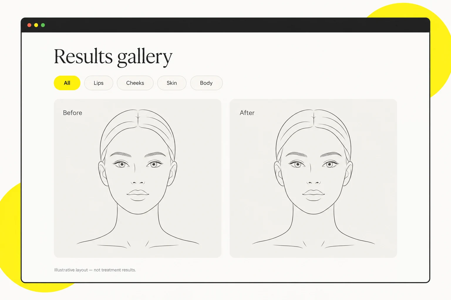 Clinic Before After Gallery Layout Illustrative clinic gallery interface with treatment filters and matching face drawings, not treatment results.