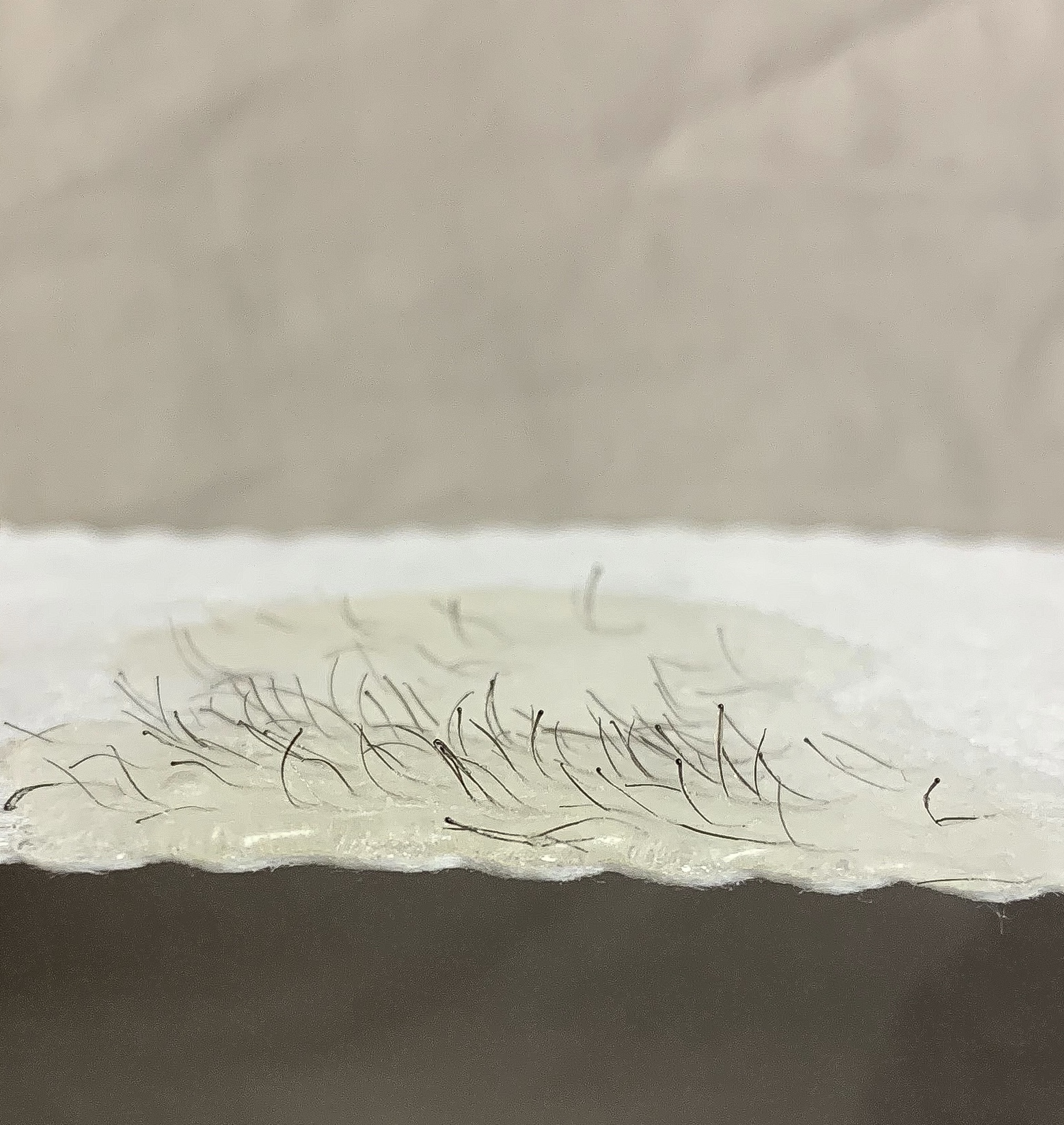 image of acupuncture process (for an acupuncturist)