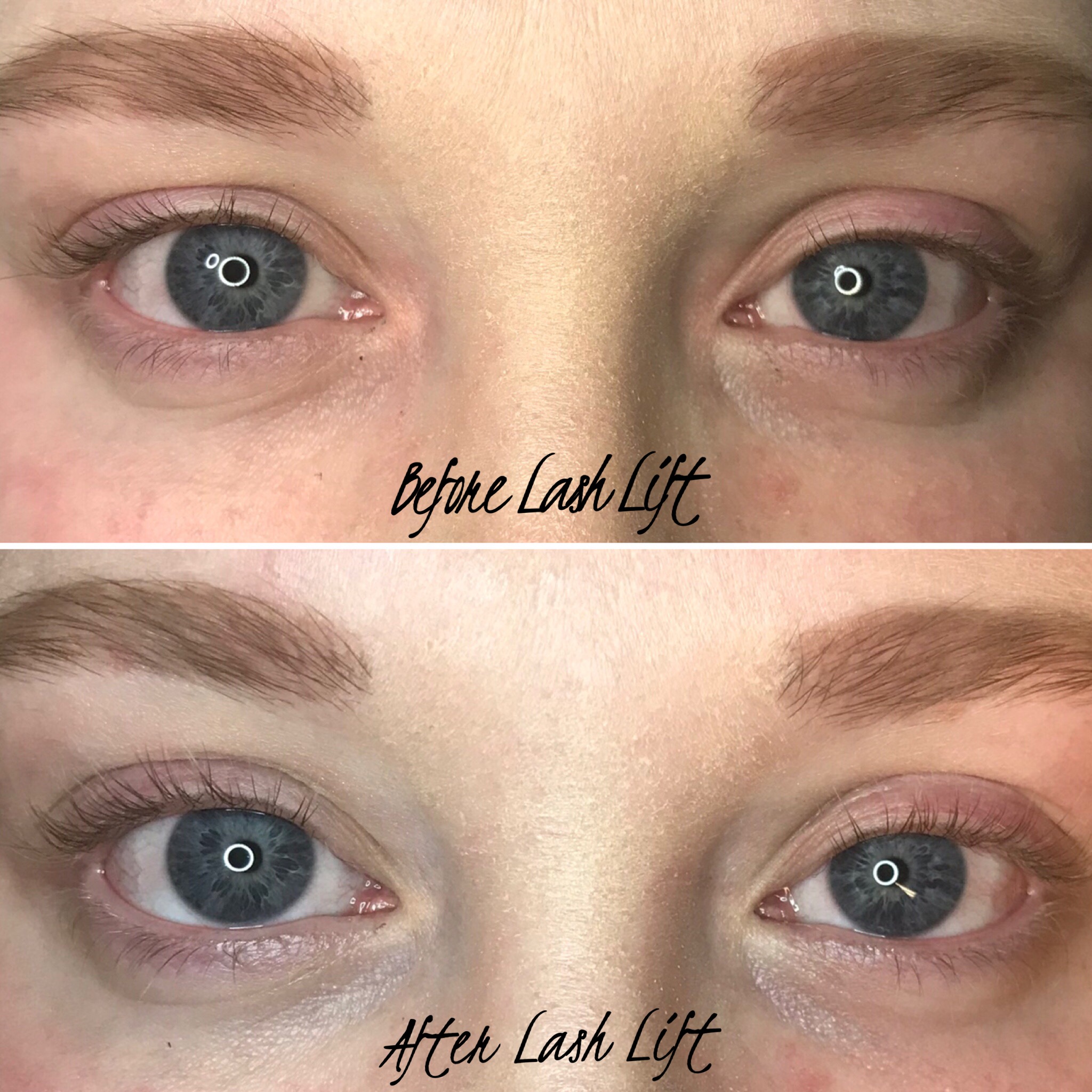 image of holistic health consultations (for an acupuncturist)