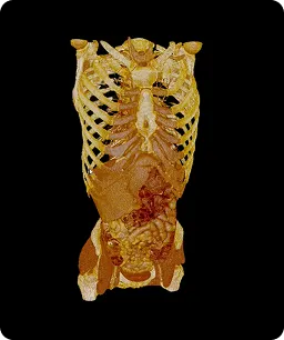 Przekroj anatomiczny ciała ludzkiego, ukazujący klatkę piersiową i narządy wewnętrzne, z wyraźnie widocznymi strukturami kostnymi i miękkimi.