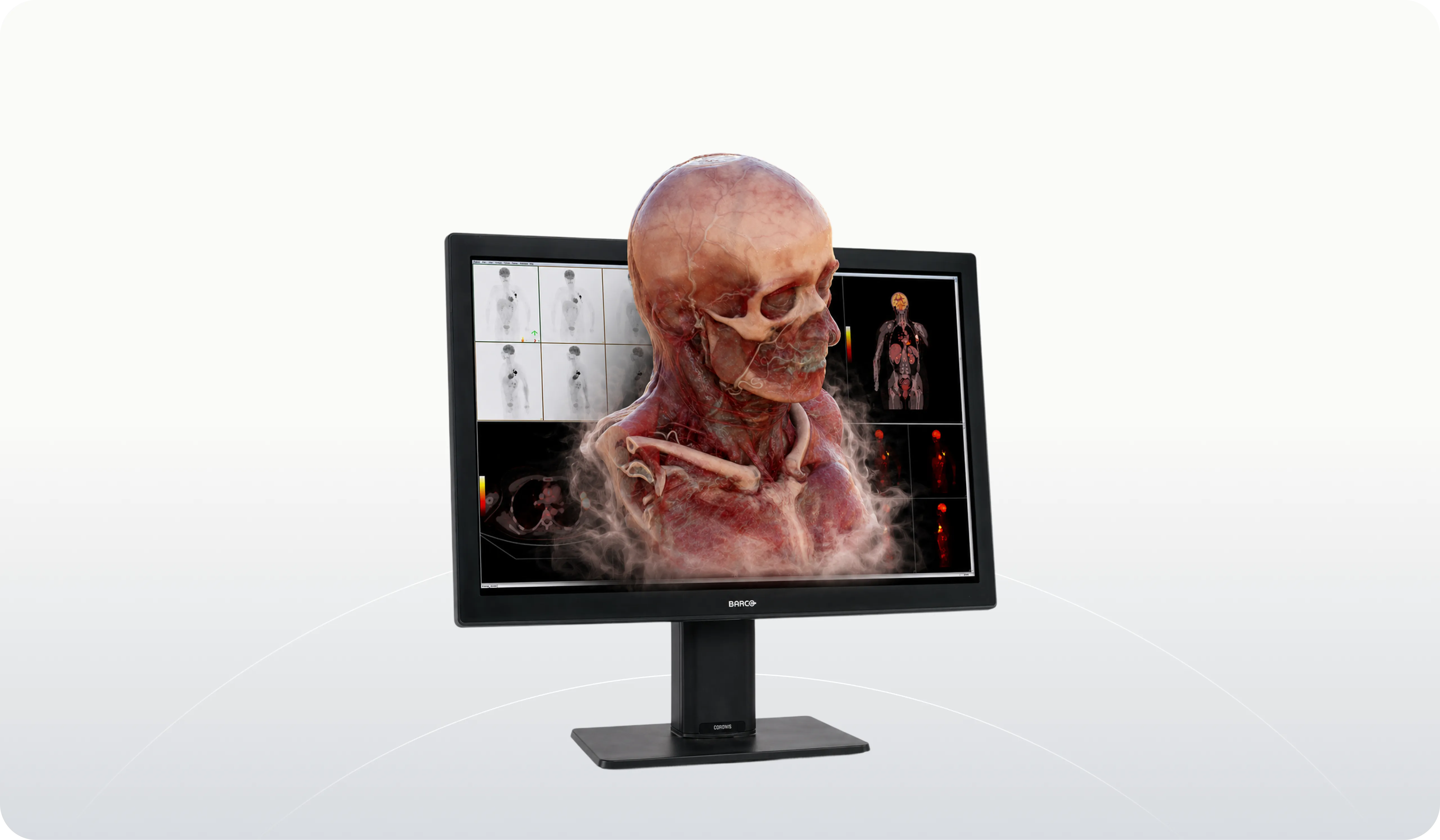 Wyświetlacz medyczny pokazujący przezroczystą 3D głowę i szyję z kośćmi i naczyniami krwionośnymi.