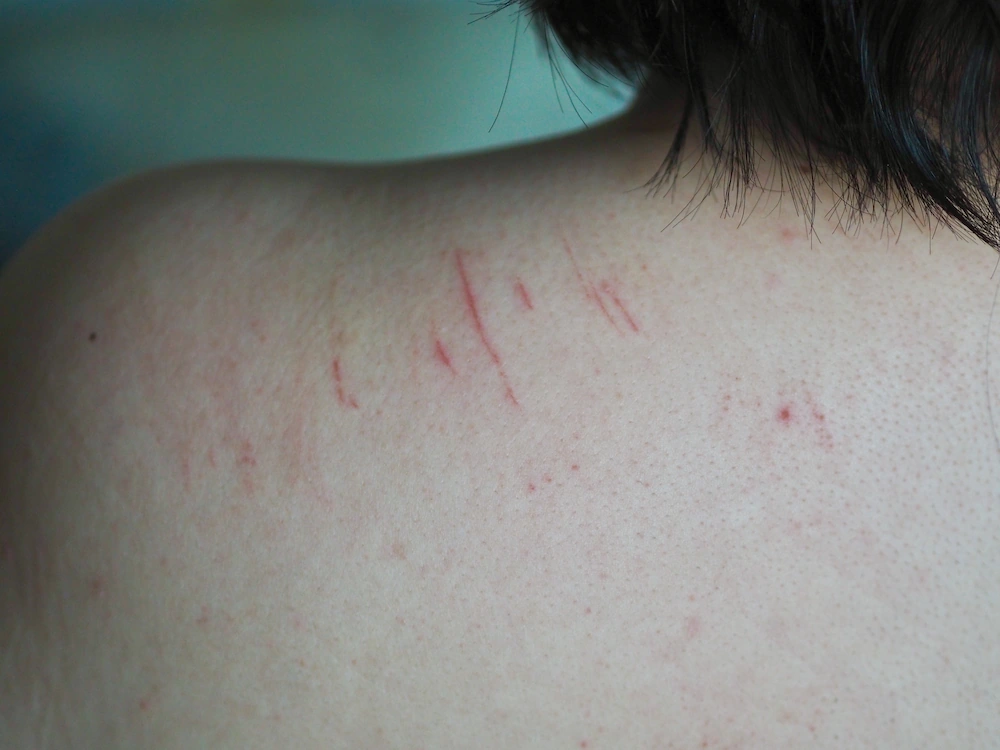 What Is Aggravated Assault in Texas?