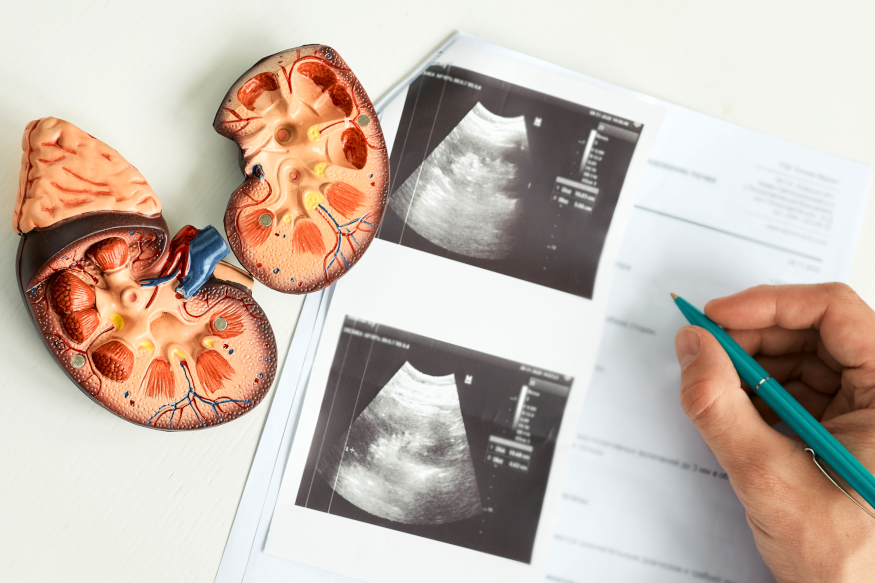 Chronic Kidney Disease