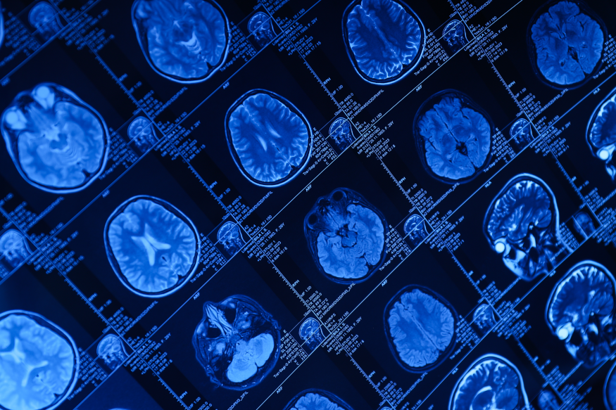 Substance Use Disorder