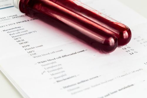 HIV/AIDS Medication Treatment