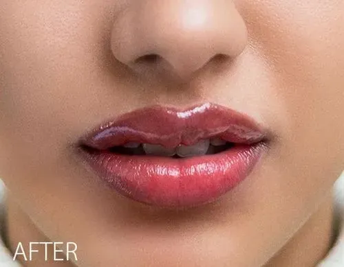 This specialized semi-permanent treatment is designed for clients with uneven lip color, pigmentation or unwanted darker areas. It focuses on color correcting and neutralizing the darker areas of the lips before applying a custom-blended pigment to achieve brighter, more even-toned lips. This is a two-appointment process, with a follow-up recommended 4-12 weeks after the initial session to assess healing and refine the results as needed.
