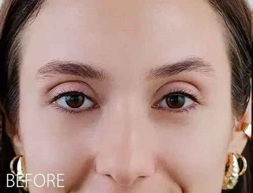Ombre Brow, also known as microshading or powder brow is a semi-permanent makeup treatment that uses a digital machine to create a soft, shaded effect. Unlike microblading, which uses hair strokes, this technique results in a soft powder look, similar to the look achieved with eyebrow powders or pencils. The treatment starts with a lighter shade at the front of the brow, fading to a deeper tone at the tail for a natural gradient. Custom-blended pigments are selected to match your natural brow color and complement your skin tone. This treatment includes two appointments, with a follow-up session 4-12 weeks after the initial visit to assess healing and refine the results as needed. 