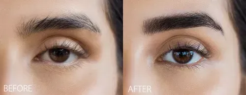 رسم الحواجب المميز بتقنية براو شعرة بشعرة، والمعروف أيضًا بتقنية المايكروبليدنج، يُستخدم لإنشاء شعيرات دقيقة تشبه شعر الحاجب الطبيعي، مما يمنحكِ مظهرًا واقعيًا وطبيعيًا للغاية. نستخدم في هذه الجلسة تقنيات متقدمة وأدوات دقيقة لتعزيز شكل الحواجب بطريقة ناعمة ومُحددة.تشمل هذه الخدمة على جلستين: الجلسة الأساسية، ثم جلسة رتوش بعد 4 إلى 12 أسبوعًا لتقييم شفاء البشرة وإجراء أي تعديلات ضرورية لتحسين النتائج.