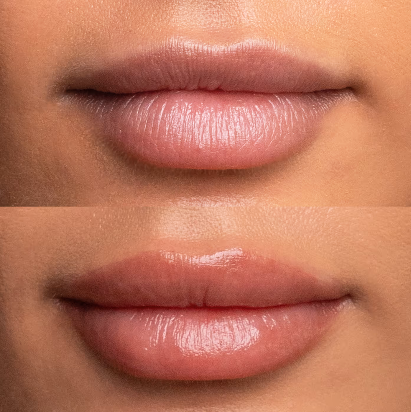 أسباب تصبغ الشفايف وأهمية جلسات التوريد في استعادة لونها الطبيعي