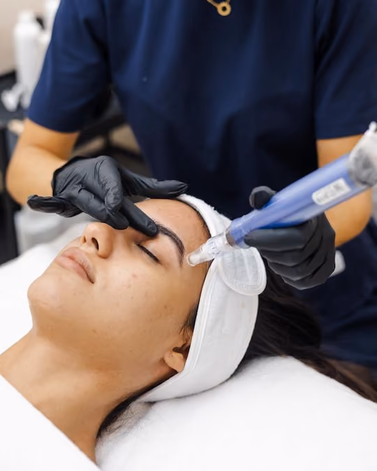 المايكرونيدلنج بجهاز SkinPen
