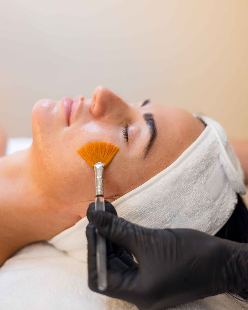The Best Chemical Peels: How to Choose the Right Peel for Your Skin