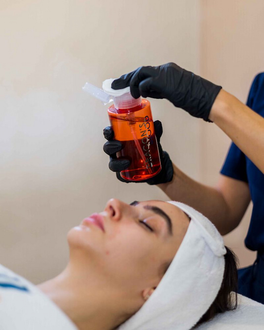 Chemical peels by acid type 