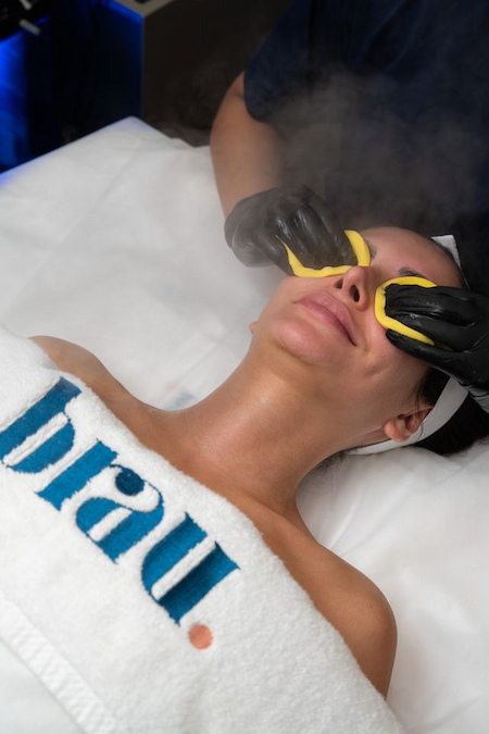 جلسة ميكرونيدلنج SkinPen لمنطقة العين في استوديو براو