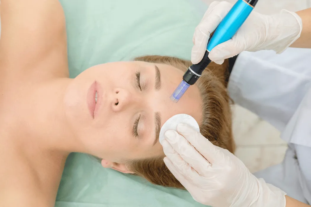 wowme-torun-mezoterapia-aminokwasowa-regeneracja-skory