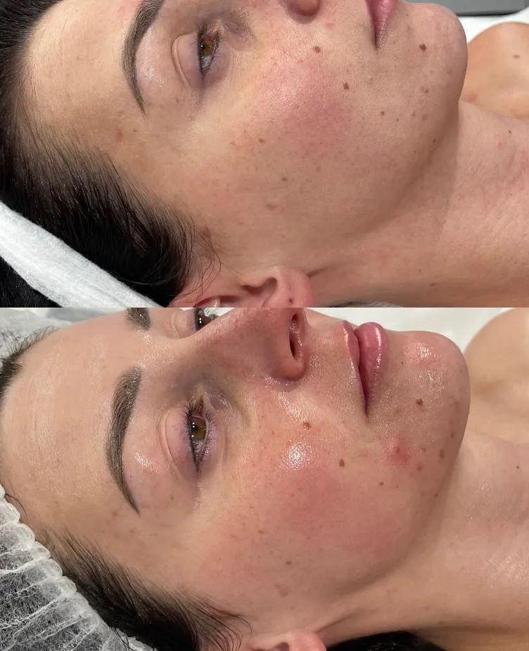 wowme-torun-metamorfoza