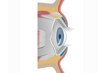 operacija-ocnih-kapaka