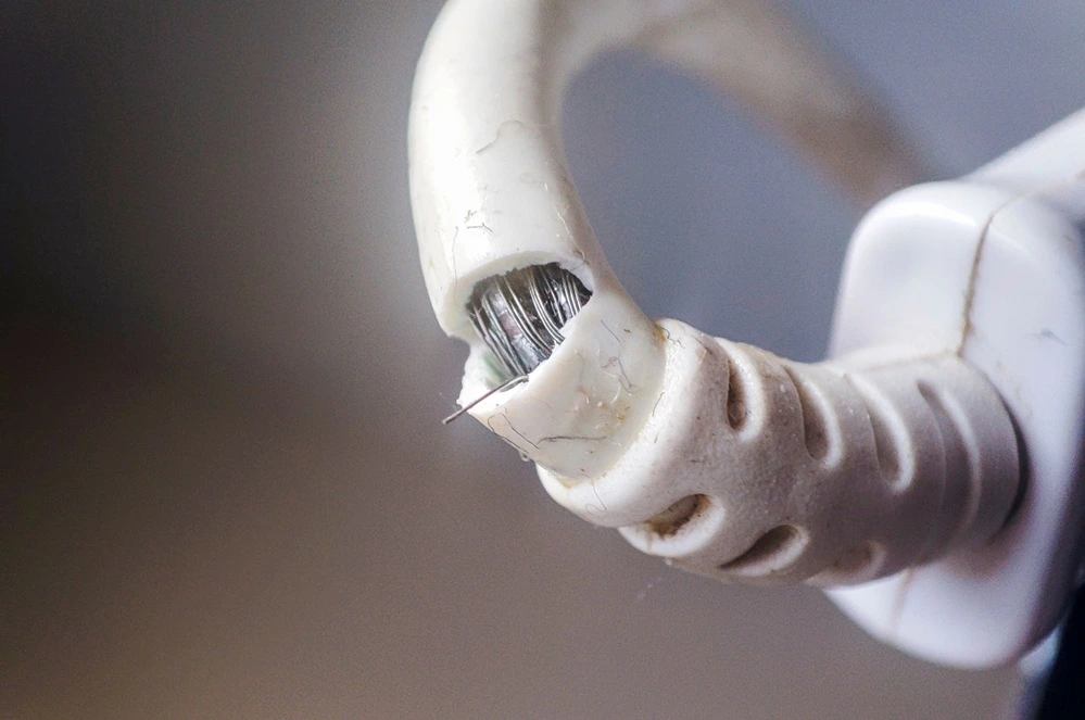 Electrical Burns